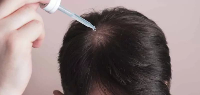 Haarwurzelentzündung natürlich behandeln: Hausmittel und natürliche Therapien